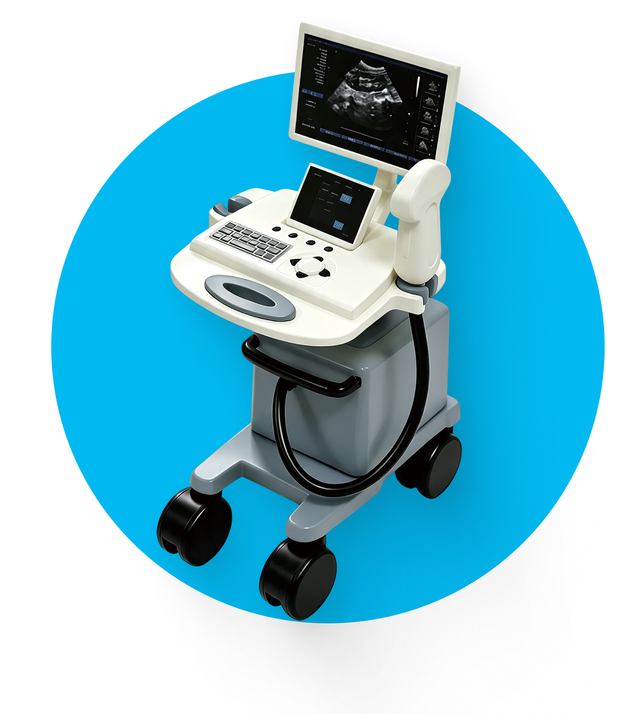 Diagnostic Ultrasound System contract manufacturing service